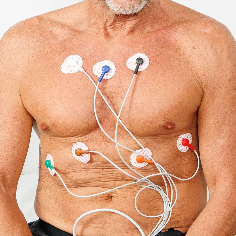 12-Lead ECG
