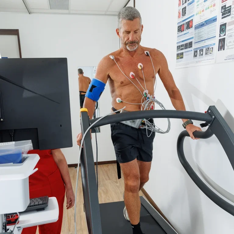 Exercise Stress Echocardiogram