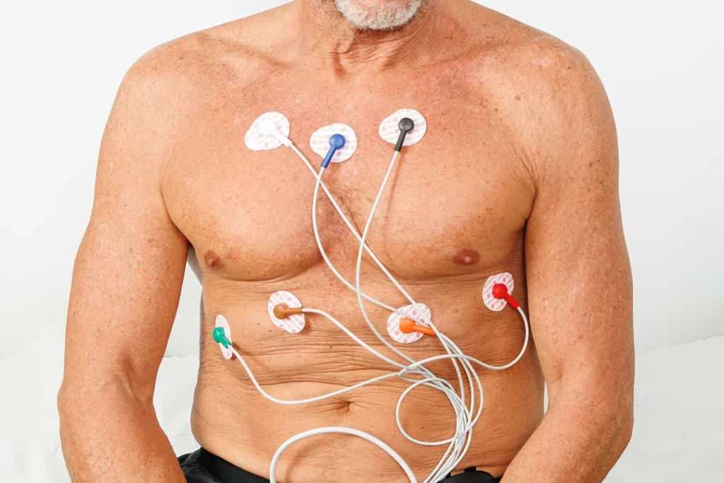Transthoracic Echocardiogram
