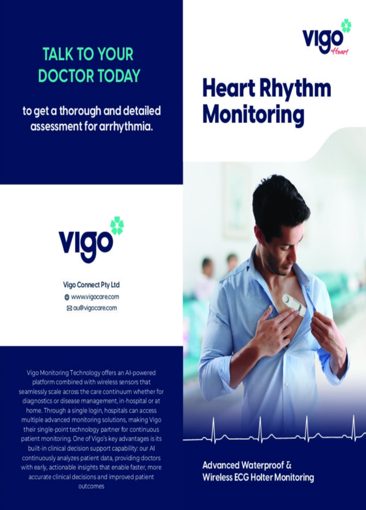Vigo Heart Rhythm Monitoring Guide